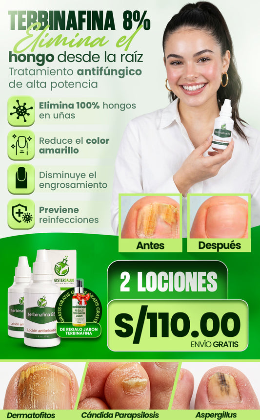 TERBINAFINA 8% ELIMINA EL HONGO DESDE LA RAIZ